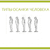 Типы осанки человека