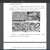 Электронно-микроскопические фотографии клеток Cupriavidus necator DSM 545, богатых ПГА